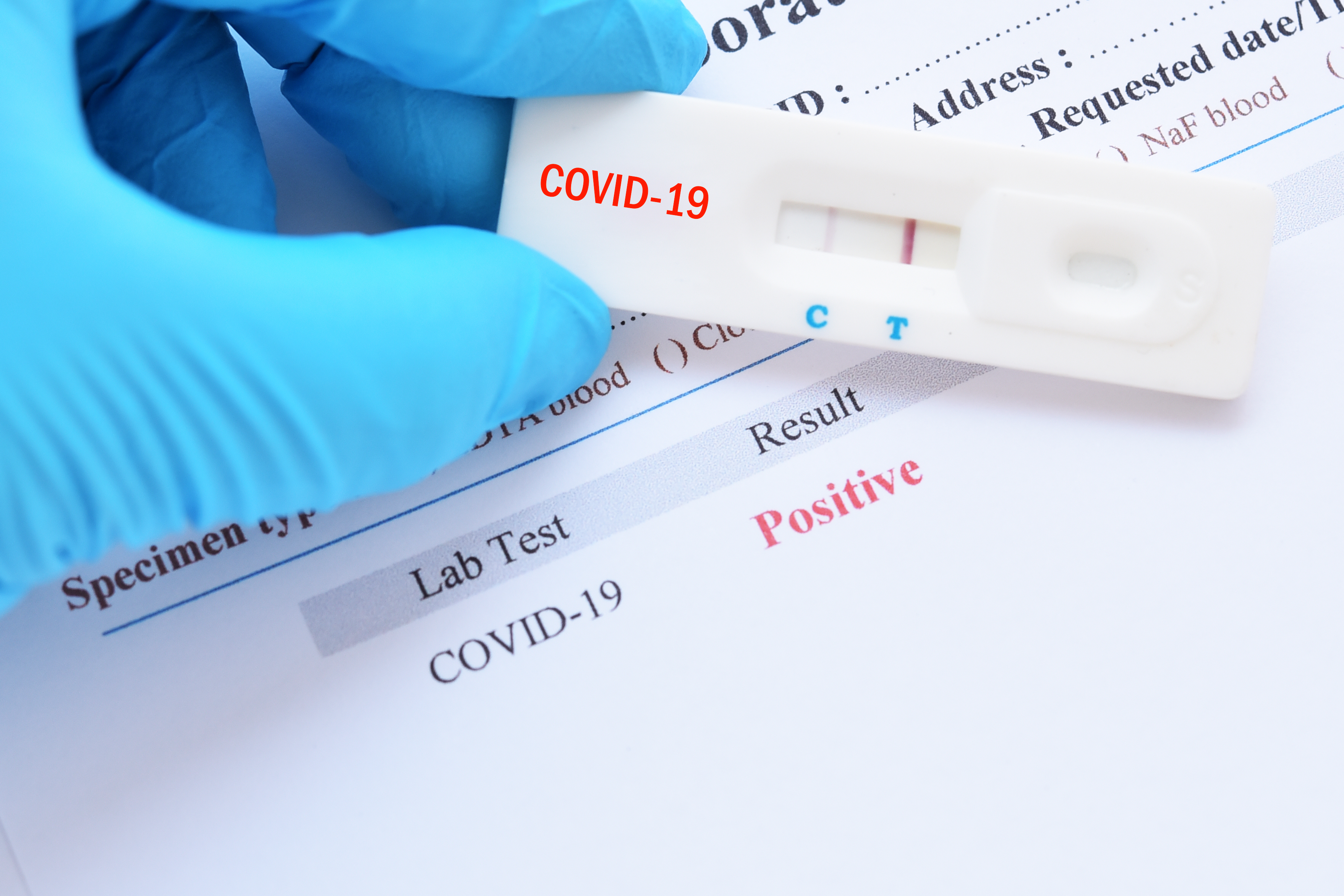 France published draft law for COVID-19 serological tests